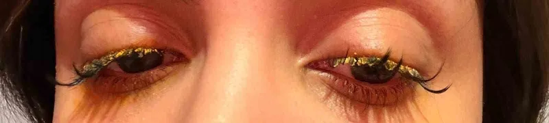 Güzellik Merkezinde Yapıştırıcı Kazası: Genç Kadın Kör Olma Tehlikesi Yaşadı