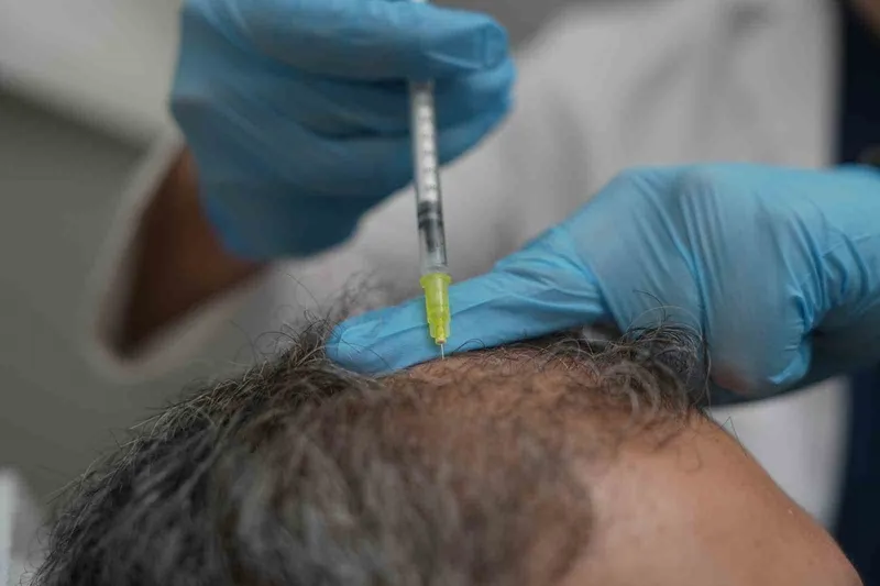 Saç Dökülmesi Vücudun Alarm Sinyali Olabilir