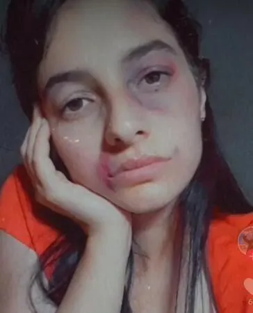 Kadına Şiddet Gittikçe Artıyor: Vatandaşlar Tepkili