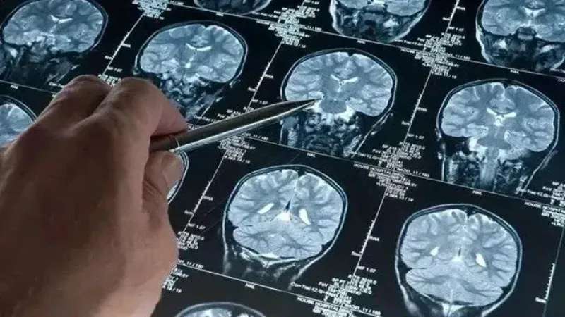 Harvard’dan Alzheimer’a Karşı Lityum Umudu