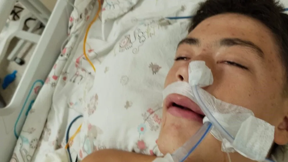 Çanakkale’de Akran Zorbalığı: Ağır Yaralanan Öğrenci Yoğun Bakımda, Tahkikat Başlatıldı